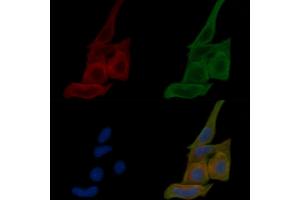 ABIN6259118 and ABIN6274339 staining Hela cells(24h of starvation treatment) by IF/ICC. (TUSC3 Antikörper  (Internal Region))
