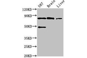 Western Blot Positive WB detected in: U87 whole cell lysate, Mouse brain tissue, Mouse liver tissue All lanes: GARS antibody at 3 μg/mL Secondary Goat polyclonal to rabbit IgG at 1/50000 dilution Predicted band size: 84 kDa Observed band size: 84 kDa (GARS Antikörper  (AA 1-389))