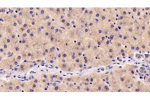 Detection of IGF1 in Human Liver Tissue using Monoclonal Antibody to Insulin Like Growth Factor 1 (IGF1) (IGF1 Antikörper  (AA 49-118))