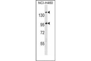 Western blot analysis of SSC5D Antibody  in NCI-H460 cell line lysates (35ug/lane). (SSC5D Antikörper  (Middle Region))