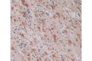 Figure. (LPCAT3 Antikörper  (AA 122-233))