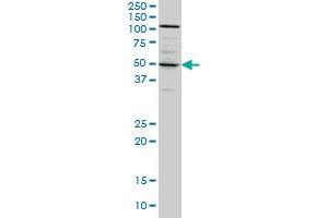 SYT4 monoclonal antibody (M04A), clone 5F8 Western Blot analysis of SYT4 expression in A-431 . (SYT4 Antikörper  (AA 1-99))