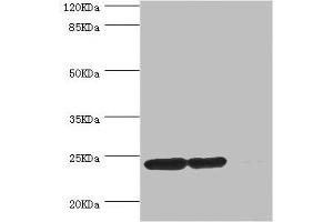 Western blot All lanes: DTYMK antibody at 5. (DTYMK Antikörper  (AA 1-212))