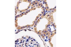 Immunohistochemistry (Paraffin-embedded Sections) (IHC (p)) image for anti-Adenylate Kinase 4 (AK4) (AA 119-153) antibody (ABIN1944856)