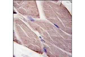 Formalin-fixed and paraffin-embedded human skeletal muscle tissue reacted with PDK4, which was peroxidase-conjugated to the secondary antibody, followed by DAB staining. (PDK4 Antikörper  (Middle Region))