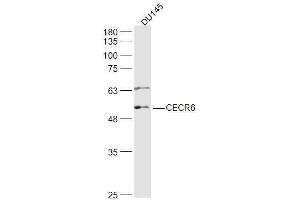 DU145 lysates probed with CECR6 Polyclonal Antibody, Unconjugated  at 1:500 dilution and 4˚C overnight incubation. (CECR6 Antikörper)