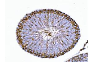 IHC analysis of TRBP/TARBP2 using anti-TRBP/TARBP2 antibody (ABIN7600548). (TARBP2 Antikörper  (AA 20-366))