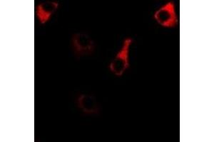 Immunofluorescent analysis of RPS14 staining in MCF7 cells. (RPS14 Antikörper)