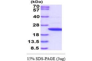 SDS-PAGE (SDS) image for Adenine Phosphoribosyltransferase (APRT) (AA 1-180) protein (ABIN666946) (APRT Protein (AA 1-180))