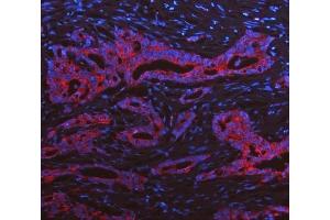 IF analysis of Cytokeratin 19 using anti-Cytokeratin 19 antibody (ABIN3043288).