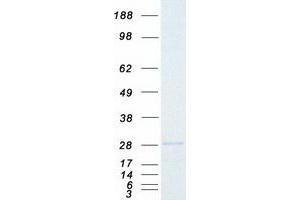 Western Blotting (WB) image for Hypoxanthine phosphoribosyltransferase 1 (HPRT1) protein (Myc-DYKDDDDK Tag) (ABIN2723034)