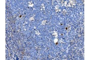 IHC analysis of JUNB using anti-JUNB antibody (ABIN7601187).