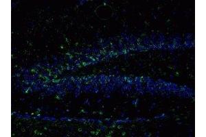 Immunostaining of mouse dentate gyrus 48 hour post TMT treatment showing NR2B when phosphorylated at Tyr1336 in green and nuclei in blue. (GRIN2B Antikörper  (pTyr1336))