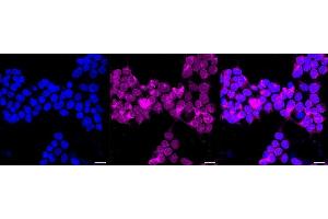 Immunocytochemical staining of Hela cells with PRKCSH antibody (ABIN7799984), 1:1,000). (Rekombinanter PRKCSH Antikörper)
