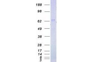 Western Blotting (WB) image for Interleukin-1 Receptor-Associated Kinase 1 (IRAK1) (Transcript Variant 3) protein (Myc-DYKDDDDK Tag) (ABIN2723777)