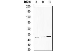 Western blot analysis of CD75 expression in HepG2 (A), HeLa (B), RAW264. (ST6GAL1 Antikörper  (Center))
