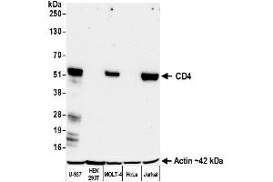 Western Blotting (WB) image for anti-CD4 (CD4) (AA 26-397) antibody (ABIN7455077)