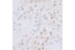 Immunohistochemistry (IHC) image for anti-RNA Polymerase-Associated Protein CTR9 Homolog (CTR9) (AA 1123-1173) antibody (ABIN7453428) (CTR9 Antikörper  (AA 1123-1173))