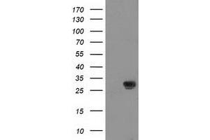 HEK293T cells were transfected with the pCMV6-ENTRY control (Left lane) or pCMV6-ENTRY NNMT (Right lane) cDNA for 48 hrs and lysed. (NNMT Antikörper)