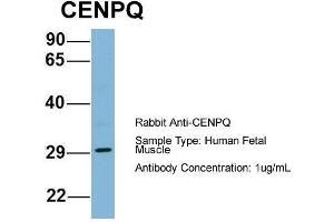 Host: Rabbit  Target Name: CENPQ  Sample Tissue: Human Fetal Muscle  Antibody Dilution: 1. (CENPQ Antikörper  (N-Term))