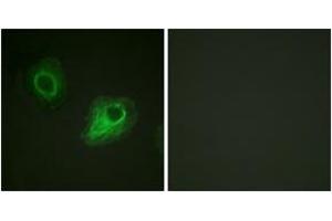 Immunofluorescence analysis of HeLa cells, using VEGFR2 (Ab-1054) Antibody. (VEGFR2/CD309 Antikörper  (AA 1020-1069))