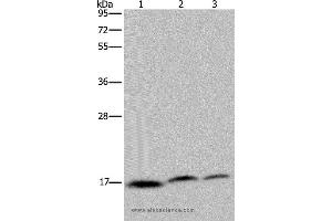 Western blot analysis of Jurkat, Hela and K562 cell, using NDUFAF4 Polyclonal Antibody at dilution of 1:350 (NDUFAF4 Antikörper)