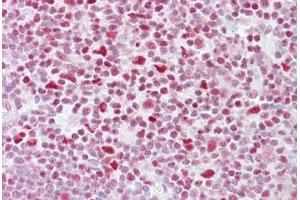 Anti-NFATC3 antibody IHC staining of human thymus. (NFATC3 Antikörper  (AA 324-373))