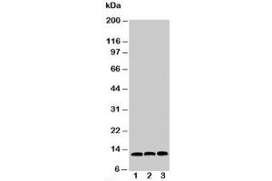 Western blot testing of MIF antibody and Lane 1:  HeLa;  2: COLO320;  3: MM231 cell lysate (MIF Antikörper  (C-Term))