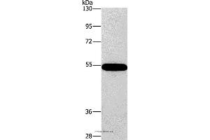 Western blot analysis of 293T cell, using CNDP1 Polyclonal Antibody at dilution of 1:320
