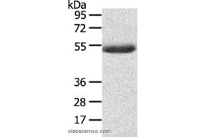 Western blot analysis of Mouse plasma tissue , using AGPAT6  Polyclonal Antibody at dilution of 1:400