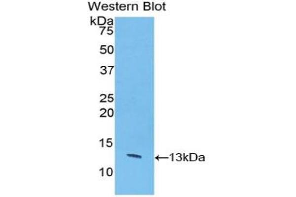 Caspase 6 Antikörper  (AA 81-179)