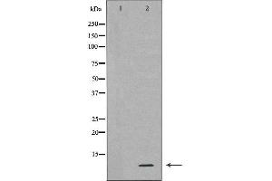 Western blot analysis of extracts of HL-60 , using RPS27A antibody. (RPS27A Antikörper  (Internal Region))
