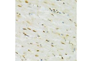 Immunohistochemistry of paraffin-embedded rat heart using ADAR antibody. (ADAR Antikörper  (AA 150-250))