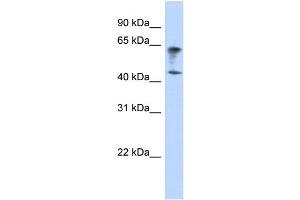 WB Suggested Anti-IGSF11 Antibody Titration:  0. (IGSF11 Antikörper  (Middle Region))