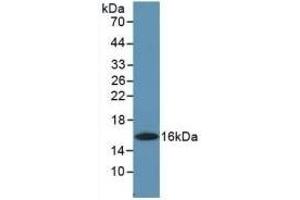 Detection of Recombinant GMCSF, Human using Polyclonal Antibody to Colony Stimulating Factor 2, Granulocyte Macrophage (GM-CSF) (GM-CSF Antikörper  (AA 18-144))