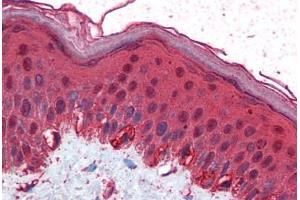 Human Skin (formalin-fixed, paraffin-embedded) stained with TFAP2C antibody ABIN351479 at 2. (TFAP2C Antikörper  (AA 270-281))