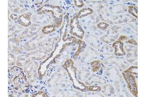 Immunohistochemistry of paraffin-embedded rat kidney using ITGAV antibody (ABIN1873308) at dilution of 1:50 (40x lens).
