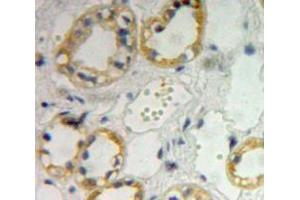 Used in DAB staining on fromalin fixed paraffin-embedded kidney tissue (IL4 Receptor Antikörper  (AA 26-233))