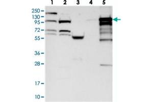 Western blot analysis of Lane 1: RT-4, Lane 2: U-251 MG, Lane 3: Human Plasma, Lane 4: Liver, Lane 5: Tonsil with BANK1 polyclonal antibody . (BANK1 Antikörper)