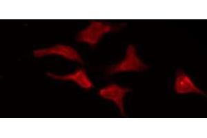 Immunofluorescence (fixed cells) (IF/ICC) image for anti-Potassium Voltage-Gated Channel, Subfamily F, Member 1 (KCNF1) (Internal Region) antibody (ABIN6258650)