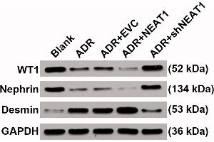 Western Blotting (WB) image for anti-Wilms Tumor 1 (WT1) (AA 1-302) antibody (ABIN3021698)