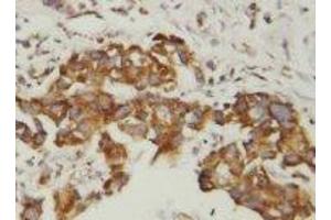 Image no. 1 for anti-Superoxide Dismutase (AA 113-129) antibody (ABIN1493374) (Superoxide Dismutase (AA 113-129) Antikörper)