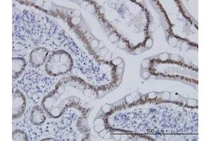 Image no. 1 for anti-Transcription Factor 7-Like 2 (T-Cell Specific, HMG-Box) (TCF7L2) (AA 1-456) antibody (ABIN466103) (TCF7L2 Antikörper  (AA 1-456))