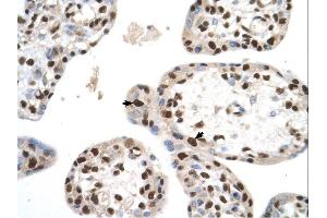 SETD2 antibody was used for immunohistochemistry at a concentration of 4-8 ug/ml. (SETD2 Antikörper  (N-Term))