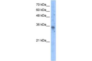 Western Blotting (WB) image for anti-Solute Carrier Family 25 (Mitochondrial Carrier, Graves Disease Autoantigen), Member 16 (SLC25A16) antibody (ABIN2462778) (SLC25A16 Antikörper)
