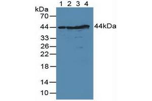 Figure. (DFFA Antikörper  (AA 51-305))