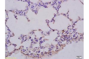 Formalin-fixed and paraffin embedded rat lung labeled with Anti-GRB10 Polyclonal Antibody, Unconjugated (ABIN680428) at 1:200 followed by conjugation to the secondary antibody and DAB staining (GRB10/14 (AA 501-594) Antikörper)