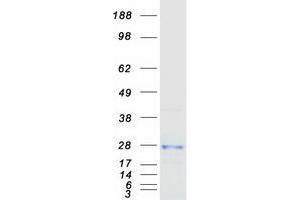 Western Blotting (WB) image for Transmembrane Emp24 Protein Transport Domain Containing 9 (TMED9) protein (Myc-DYKDDDDK Tag) (ABIN2733837)