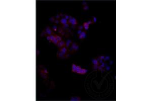 Independently Validated Antibody, image provided by Science Direct, badge number 029611:Formalin-fixed MCF7 cells labeled with Anti-Megalin Polyclonal Antibody, Cy3 Conjugated (ABIN750991) at 1:250 overnight at 4C. (LRP2 Antikörper  (AA 3401-3500))