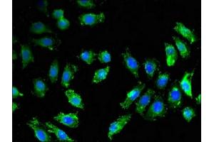 Immunofluorescent analysis of A549 cells using ABIN7145531 at dilution of 1:100 and Alexa Fluor 488-congugated AffiniPure Goat Anti-Rabbit IgG(H+L) (BACE1 Antikörper  (AA 46-155))